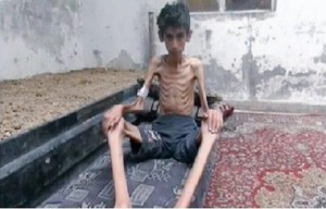 الجوع يلتهم السوريين11