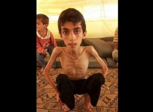 الجوع يلتهم السوريين9