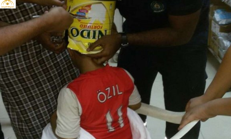 «مدني جازان» يحرر رأس طفل علق في علبة حليب...صور