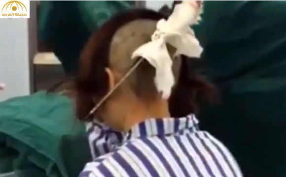 بالفيديو: امرأة تغرز ساطوراً في رأس زوجها لخيانته