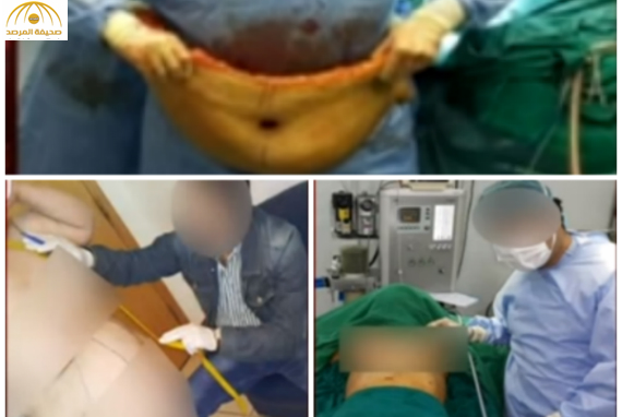 بالفيديو: فضيحة طبيب تجميل عربي في الكويت يعرض صور مرضاه وهم عراة على مواقع التواصل !!