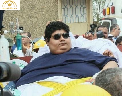 بالصور: مريض السمنة "الشاعري" يفقد 80% من وزنه