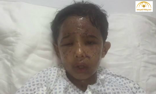 طفل فقد صديقه بقذيفة حوثية  : "مهما صار احنا عيال ملكنا سلمان" - فيديو