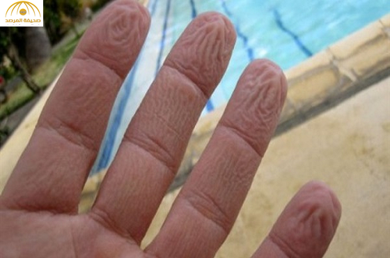 هذا هو سبب تجعد جلد أصابعنا في الماء!
