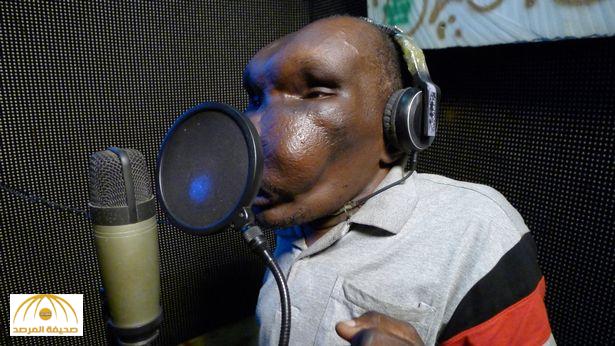 بالفيديو : شاهد صاحب أغرب رأس في أوغندا يتحول لمغني شهير