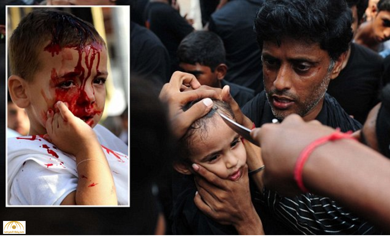 صور جديدة: طفلة تستعد لفتح فروة رأسها بـ"سكين".. ولعنة الحسين تطارد الشيعة في عاشوراء!