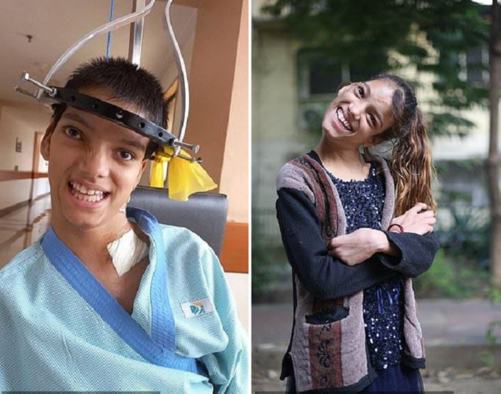 A girl suffers from a rare disease and a life-changing surgery