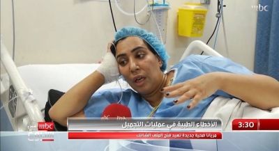 In the video, a woman tells shocking details about serious complications she suffered after undergoing plastic surgery