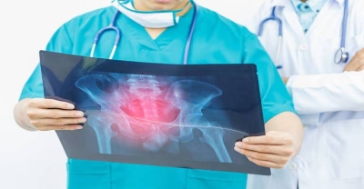 Signs of Bone Cancer: NHS Reveals 3 Less Obvious Symptoms