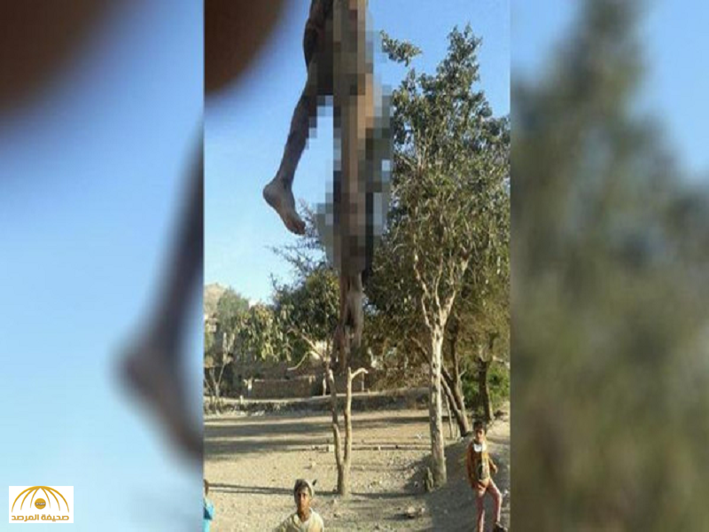 علقوه من ساقه كالشاة على جذع شجرة.. لماذا عذب الحوثيون هذا الرجل بتلك الطريقة؟-صور