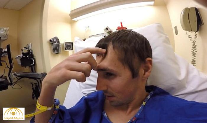 بالفيديو: أمريكي يكشف السبب وراء  تهشم جمجمته ..و هكذا فكر الأطباء بـ"الرأس البلاستيكية"
