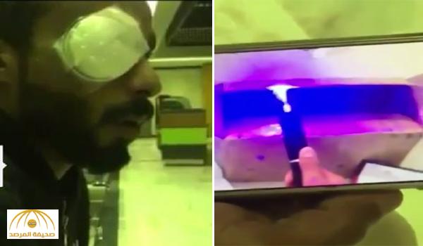 بالفيديو : مواطن يكشف كيف فقد إحدى عينيه بسبب المزاح مع صديقه بالليزر الحارق