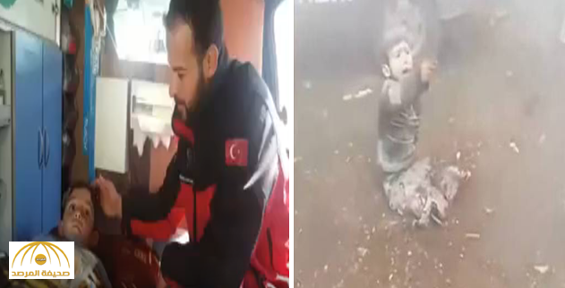 "بُترت قدماه وقُتلت والدته وأخته أمامه".. الطفل صاحب "بابا شيلني" يروي مشاهد مؤلمة لقصف بشار (فيديو)