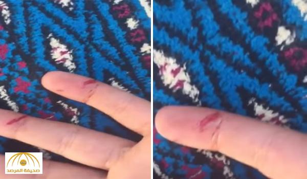 فيديو لمعلمة تُدمي أصابع طالبة بمسطرة خشبية في المدينة يثير غضب نشطاء مواقع التواصل
