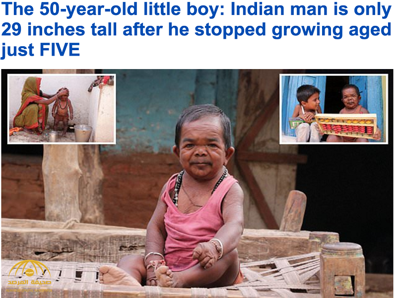 شاهد : هندي يبلغ عمره 50 عاما يشبه الأطفال.. توقف نموه في الخامسة.. ويشرب “ويسكي” يوميا!