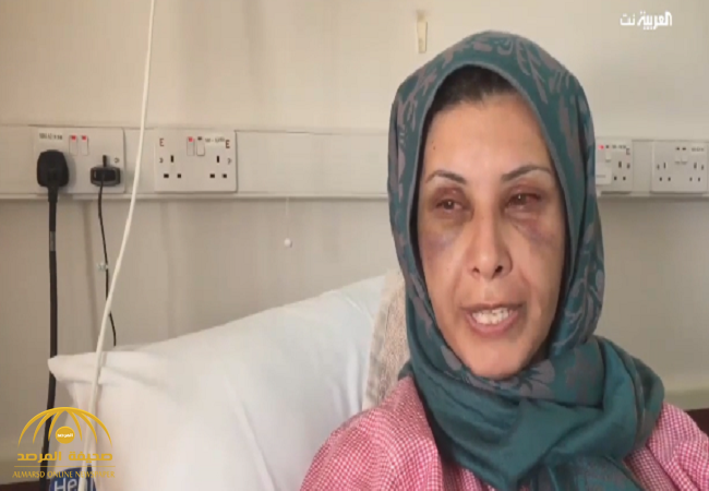 بالفيديو:المعنفة السورية زهراء تكشف تفاصيل اعتداء طليقها البحريني عليها..ولهذا السبب اراد قتلها!