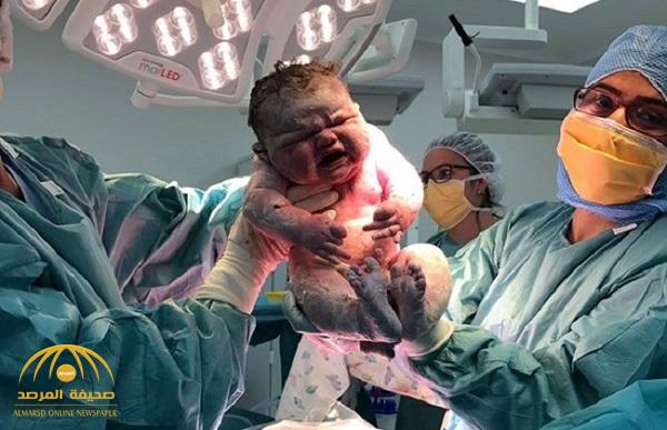 شاهد ولادة طفلة ضخمة جدا في أستراليا - صور