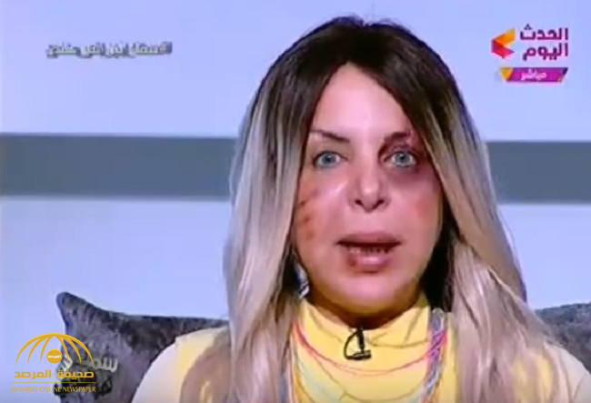شاهد:مذيعة مصرية تظهر وعلى وجهها آثار اعتداء وحشي..وهذا ما كشفته!