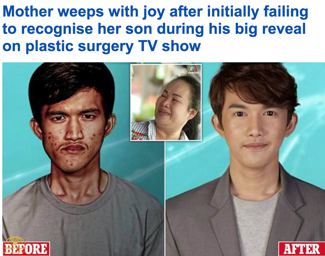 شاهد: كيف غيرت جراحة تجميلية شاب تايلاندي قبيح الوجه إلى آخر وسيم.. ولهذا السبب بكت أمه!