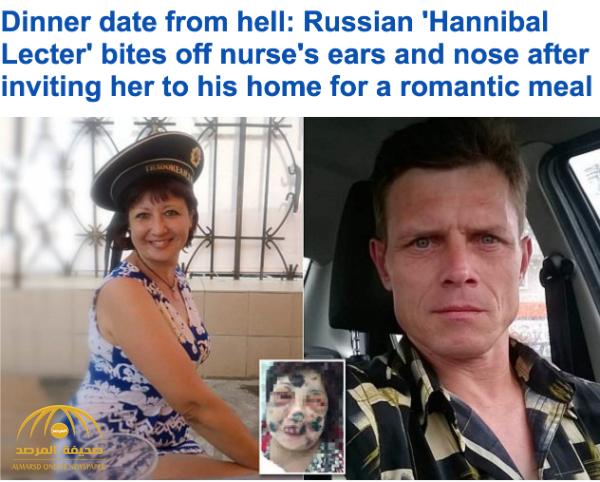 شاهد .. صور صادمة لسيدة روسية واعدت رجلاً عبر الإنترنت فنهش لحمها بأسنانه !