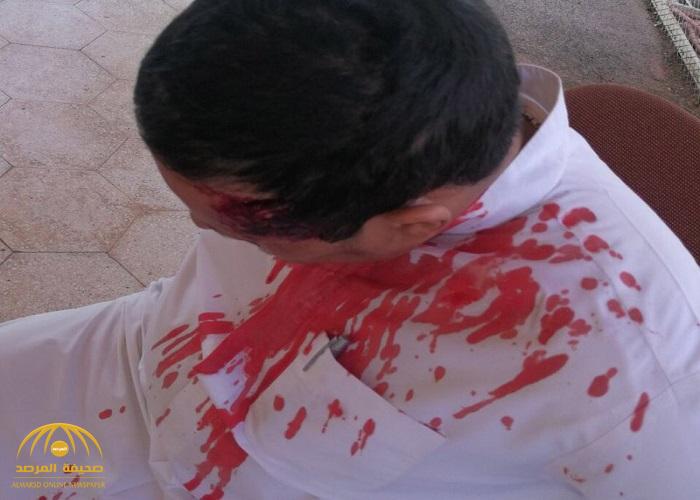 9 أشخاص ملثمين  يعتدون على مدير مدرسة بالرياض ويشجون رأسه بقطع حديدية