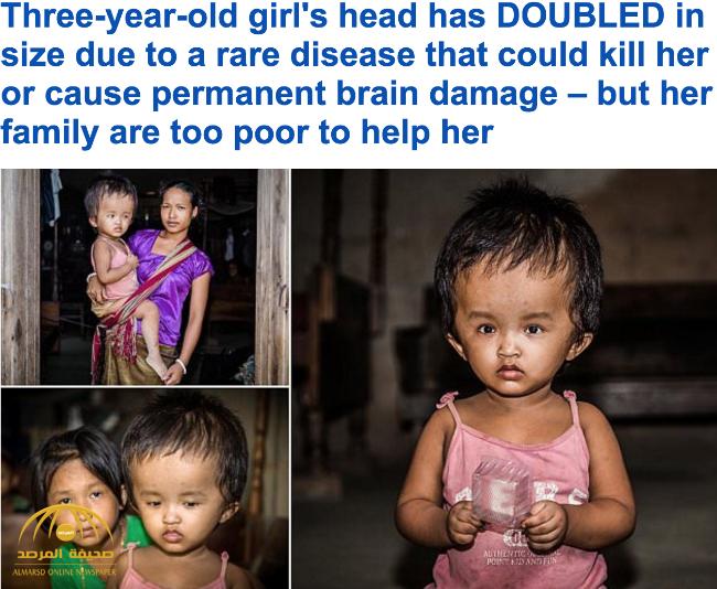 بالصور والفيديو : شاهد أغرب رأس طفلة في العالم !