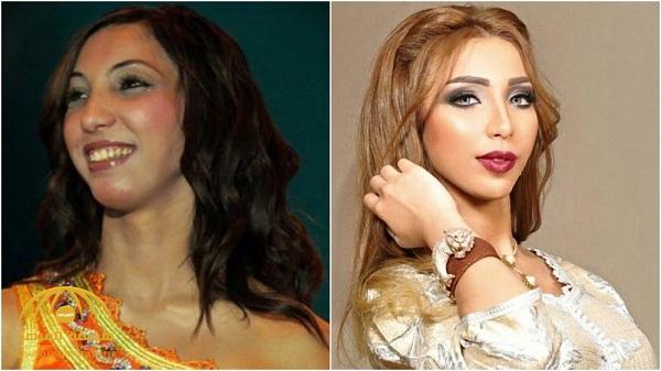شاهد المغنية المغربية "دنيا بطمة" تفاجئ متابعيها بما قالته عن خضوعها للتجميل !