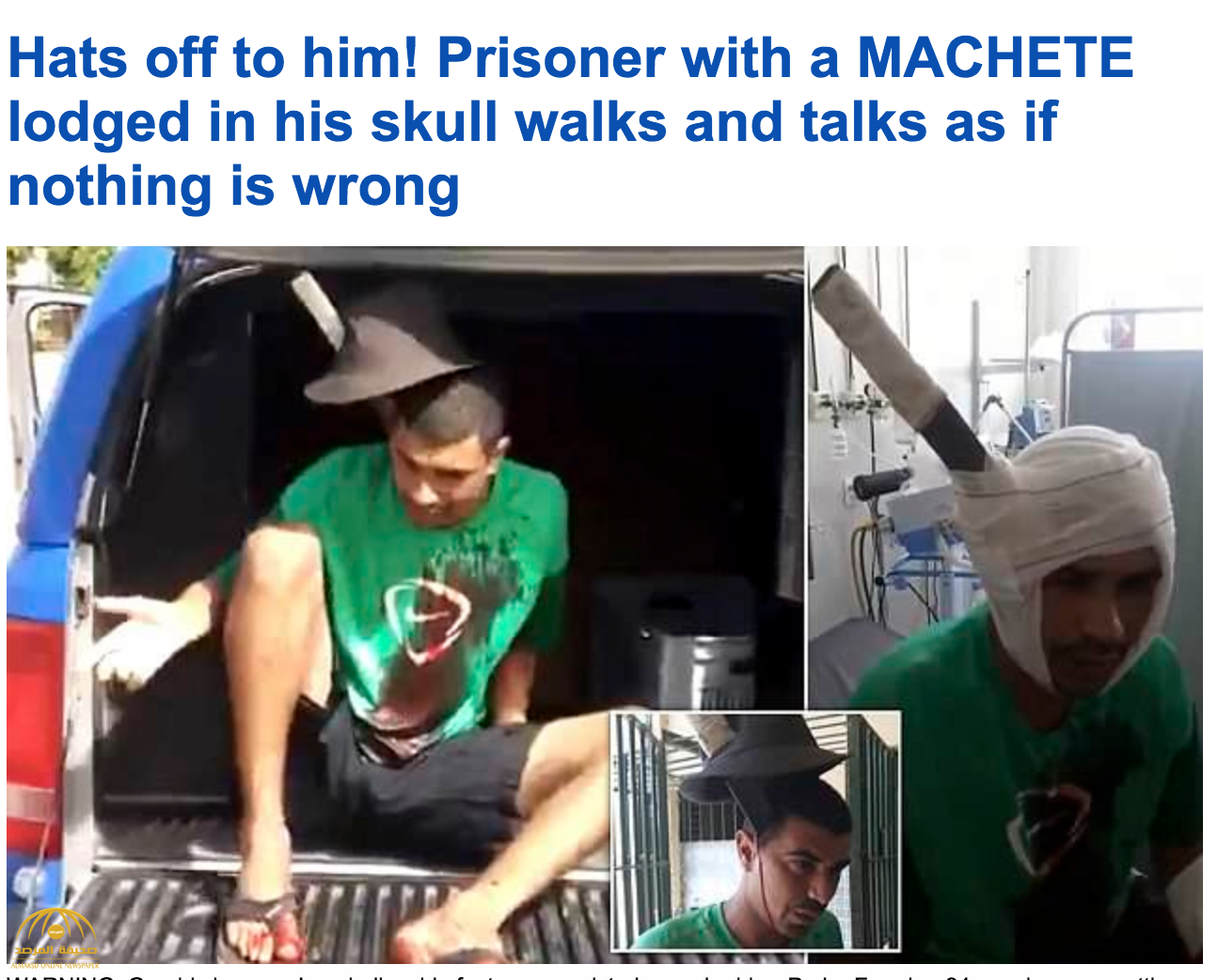شاهد .. حالة غريبة.. رجل يتحدث وحديدة ضخمة مغروسة داخل جمجمته في سجن بالبرازيل!