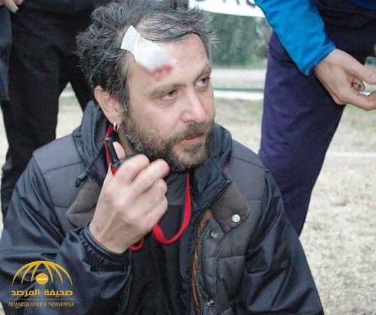 الممثل التركي نجات إشلر تعرّض للضرب... زوج معجبة انقضّ عليه!-صورة