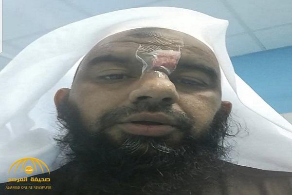 حادثة صادمة.. إمام مسجد بـ"القنفذة" يُفاجأ بلكمات على وجهه بعد فروغه من الصلاة - صور