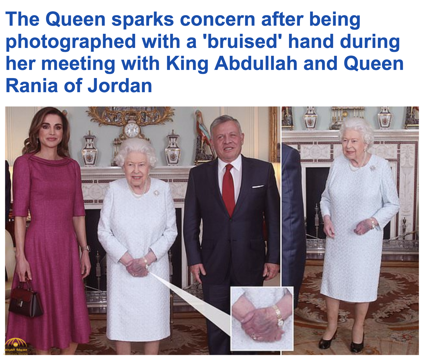 في لقاء مع ملك الأردن وزوجته.. شاهد .. لون اليد اليسرى لملكة بريطانيا يثير التساؤلات.. «أرجواني غريب»