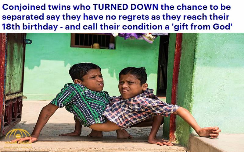 شاهد بالصور : "توأم هندي" برأسين وجسم واحد يعيشان ملتصقان منذ 18 عامًا .. يتخذان قرارًا مفاجئًا أذهل العالم!
