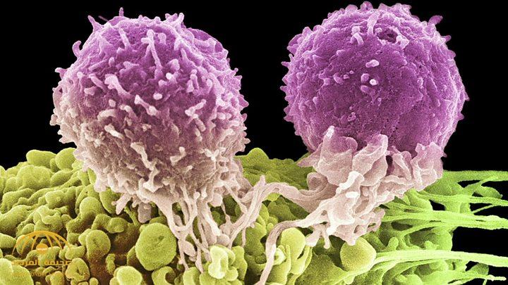 باحثون يكشفون عن "وقود السرطان" .. وهكذا يمكن تجويع خلاياه حتى الموت "بخطوة واحدة"