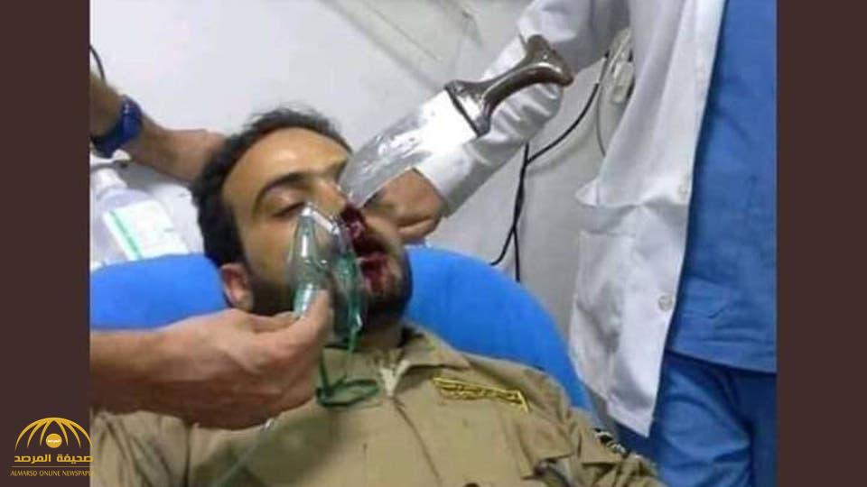 شاهد: حوثي يغرس خنجره في وجه حارس مطعم يمني في صنعاء