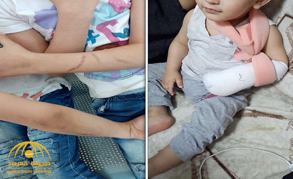 بالصور: مواطنة عبر "المرصد" تشتكي من تعنيف زوجها وضربه لأبنائها وكسر أصبع أحدهم وطردهم من المنزل في الباحة