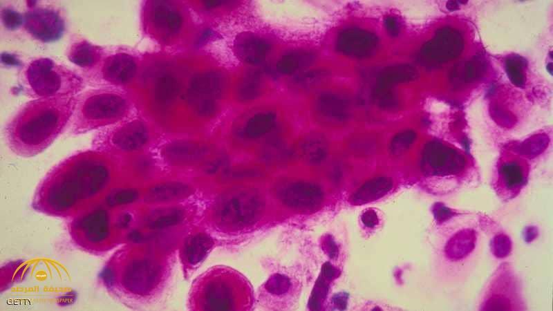 العلماء يكتشفون الخديعة الكبرى للخلايا السرطانية!