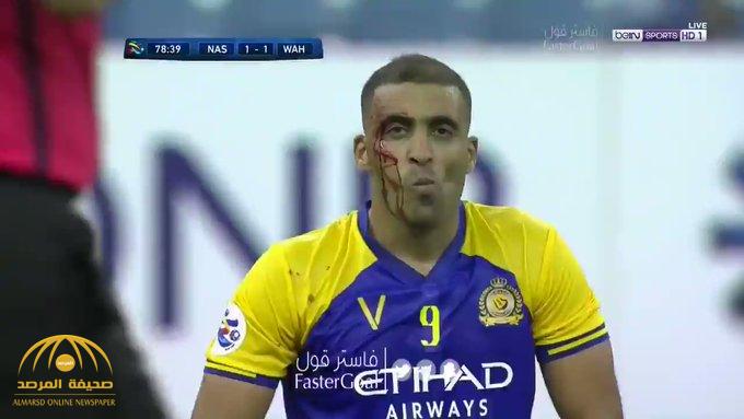 Witness Al-Nasr Hamdala was injured and was bleeding from the face of his team against Al-Wad