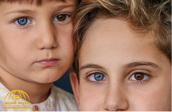 "بعين بنية وأخرى زرقاء".. شاهد : حالة نادرة يُولد بها طفلين أتراك!