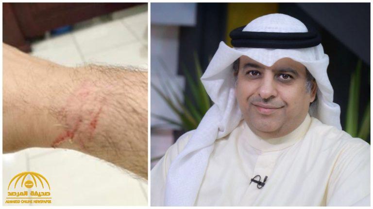 بالصور : الإعلامي ماضي الخميس يتهم الشرطة الكويتية باختطافه والاعتداء عليه .. ومفاجأة قبل إطلاق سراحه !