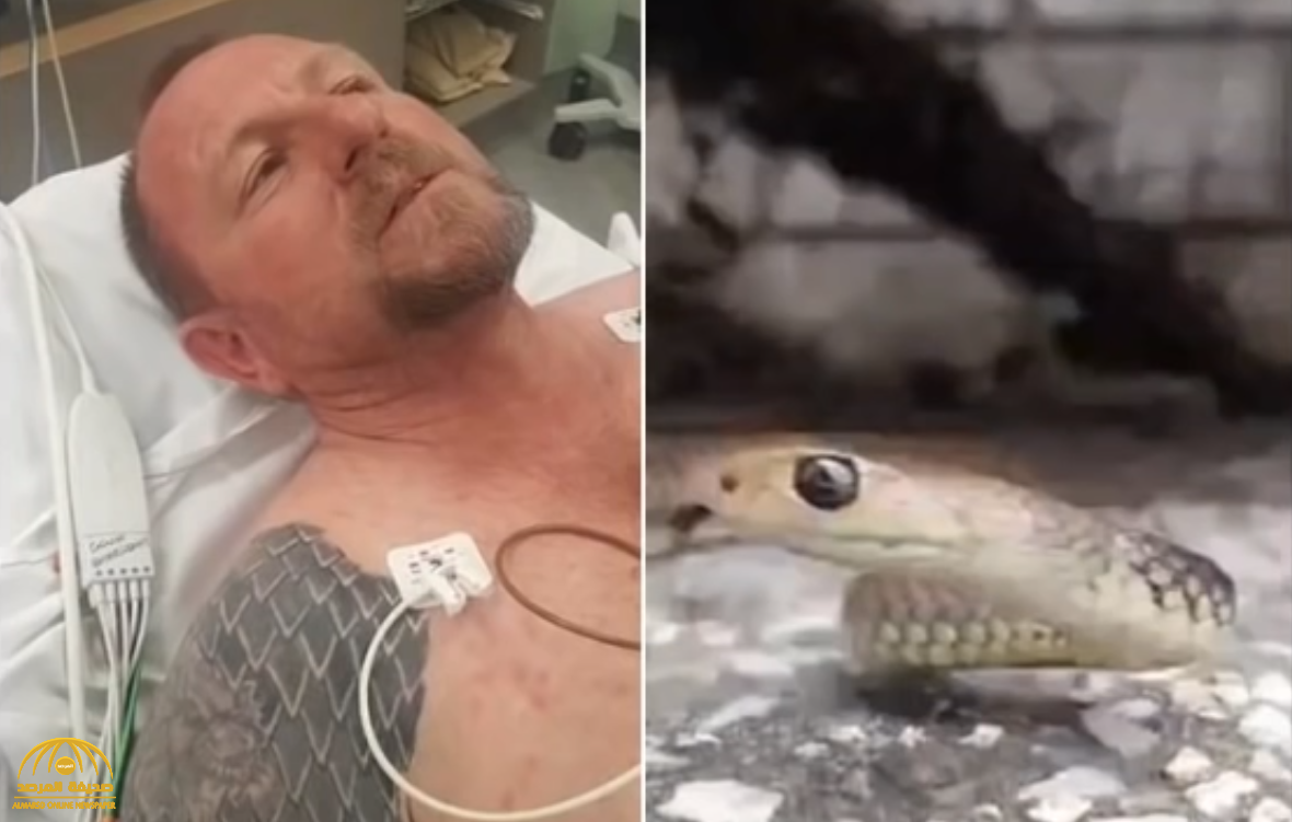 شاهد : حية سامة تلدغ خبير صيد الثعابين في أستراليا على الهواء.. والكشف عن سبب بقائه على قيد الحياة!