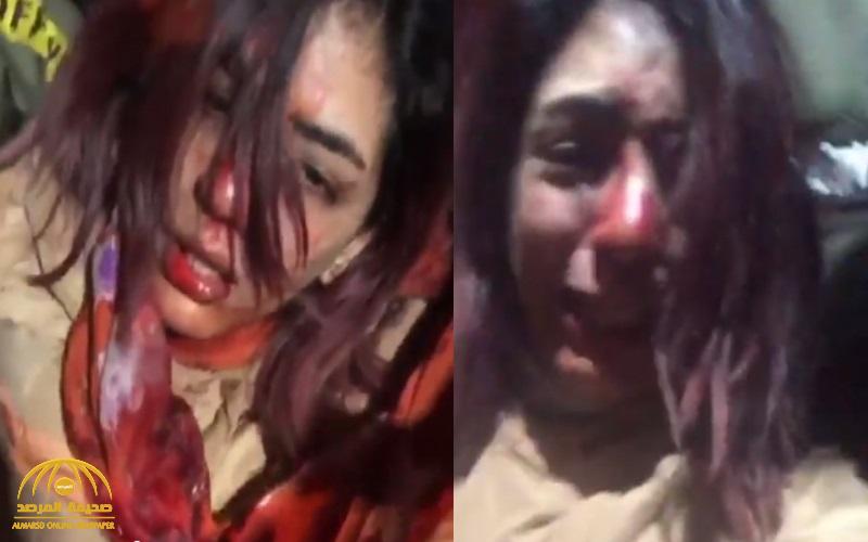 شاهد.. مغنية راب مغربية حسناء تبكي ووجها ينزف دماً بعد الاعتداء عليها في إحدى المناسبات!