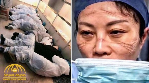 شاهد .. صور صادمة لأطباء صينيين يعملون بلا نوم لمواجهة فيروس كورونا