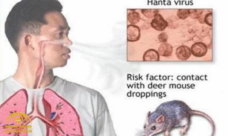 أعراضه تشبه كورونا .. فيروس "هانتا" يعاود الظهور من جديد في الصين ويتسبب في وفاة مصاب