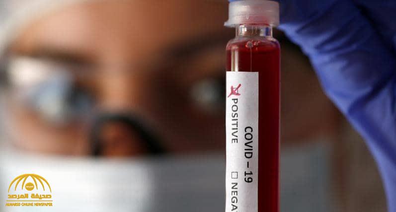 كشف فصيلة الدم الأكثر عرضة لخطر كورونا