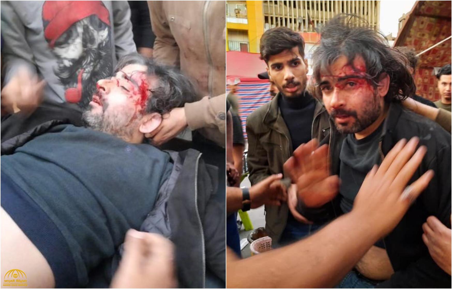 شاهد: إعلامي عراقي بارز يتعرض لهجوم عنيف بالسكاكين.. وتوأمه يتهم "جهة سياسية معروفة" – صور