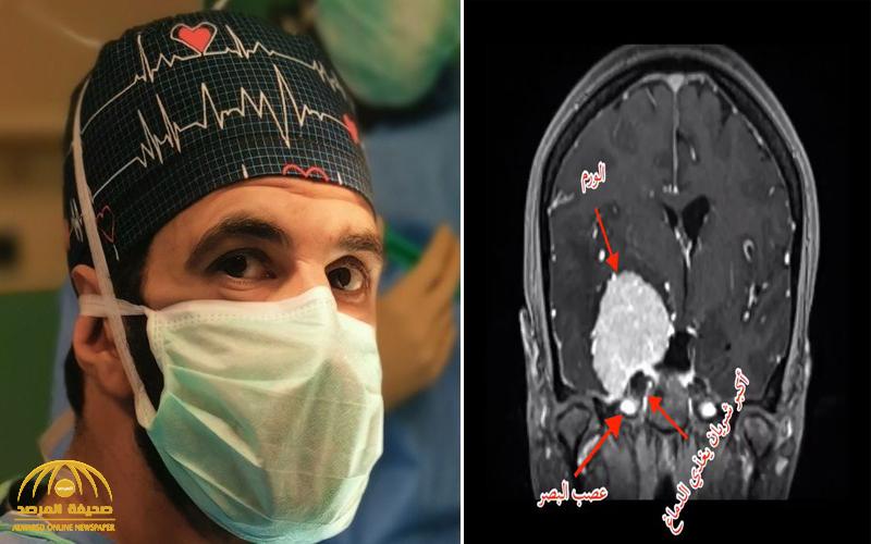 شاهد: جراح سعودي يجري جراحة خطيرة لشابة خليجية تخلى عنها طبيبها الفرنسي في اللحظات الأخيرة بسبب كورونا