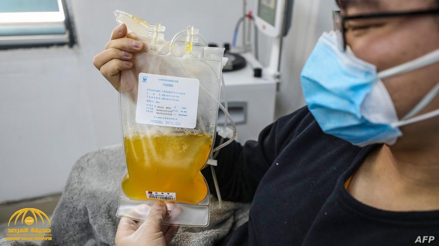 إيطاليا تزف بشرى سارة وتعلن أول حالة شفاء من "كورونا" باستخدام دماء المتعافين