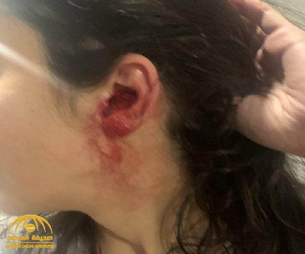 إجراء فوري من "شرطة الرياض" بعد تلقيها بلاغًا بتعرض فتاتين للتعنيف من قبل شقيقهما الخمسيني
