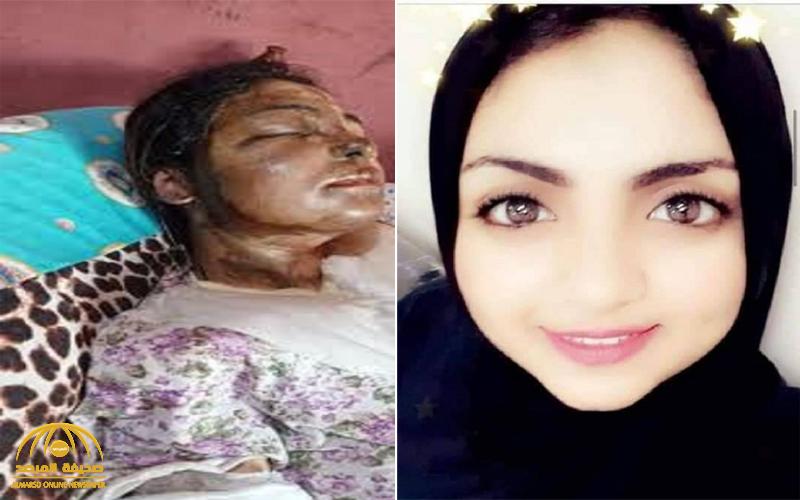 شاهد : تشويه وجه وجسد فتاة مصرية بالأسيد .. ومفاجأة بشأن هوية الجاني ودافع الجريمة!