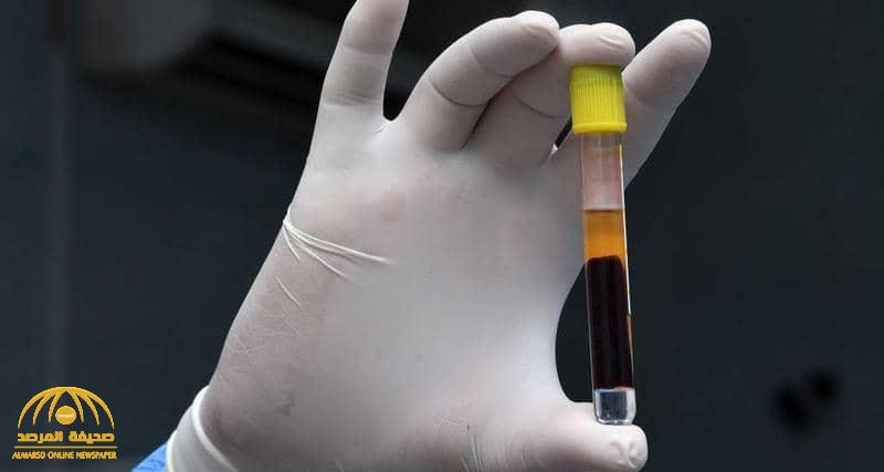 دراسة جديدة تحسم الجدل بشأن علاقة فصيلة الدم بمضاعفات فيروس كورونا